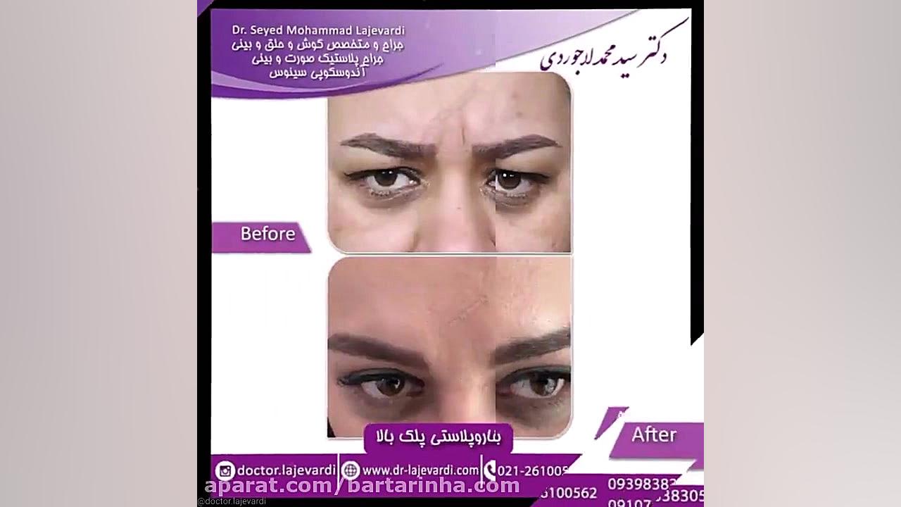 برترین ها - دکتر سید محمد لاجوردی - بورد تخصصی گوش حلق بینی و جراح سر و گردن تزریق بوتاکس