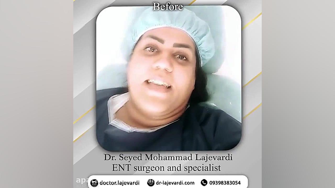 برترین ها - دکتر سید محمد لاجوردی - بورد تخصصی گوش حلق بینی و جراح سر و گردن آکنه
