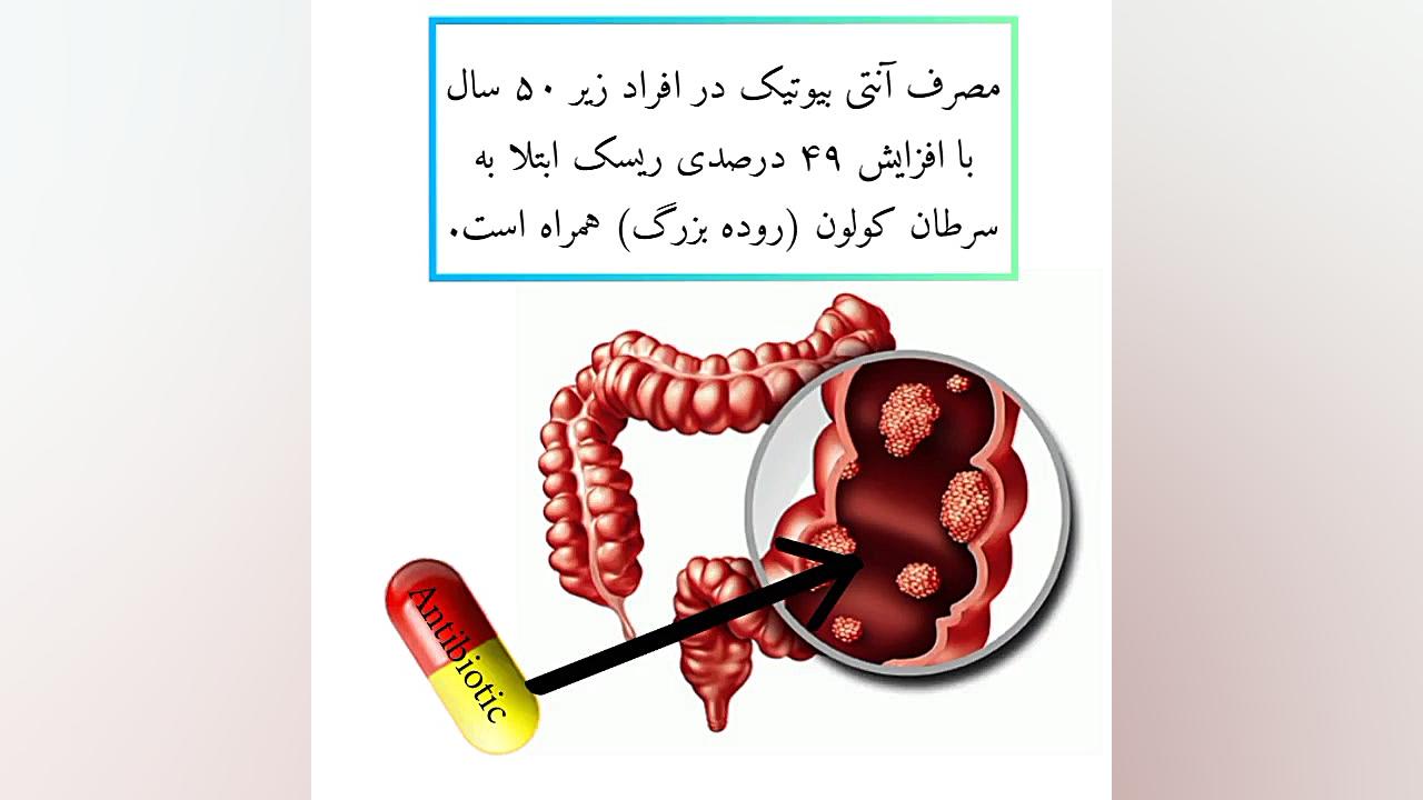 آنتی بیوتیک پروتز دندان