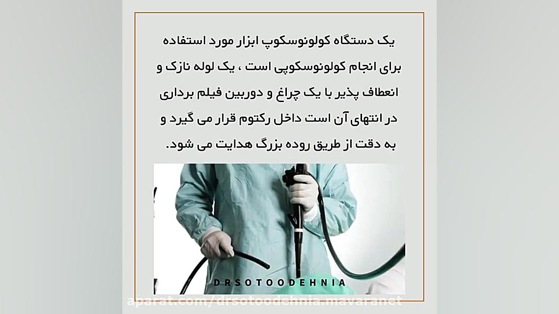 عملکرد کولونوسکوپی آر اف فرکشنال