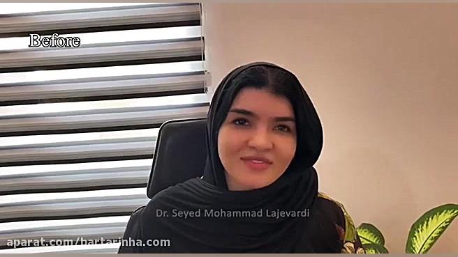 برترین ها - دکتر سید محمد لاجوردی - بورد تخصصی گوش حلق بینی و جراح سر و گردن برداشتن توده