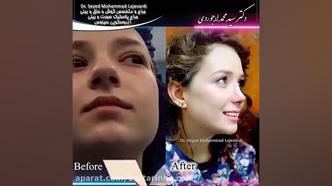 برترین ها - دکتر سید محمد لاجوردی - بورد تخصصی گوش حلق بینی و جراح سر و گردن رفع افتادگی پلک