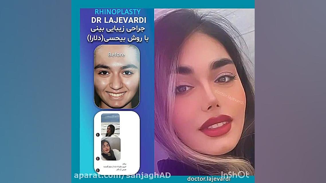 عمل زیبایی دکتر لاجوردی وزارتان