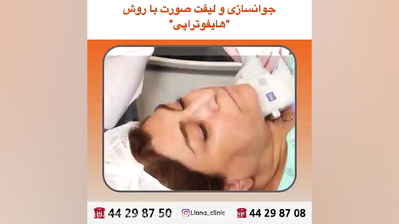 جوانسازی و لیفت صورت با هایفوتراپی کرانیوسینوستوز