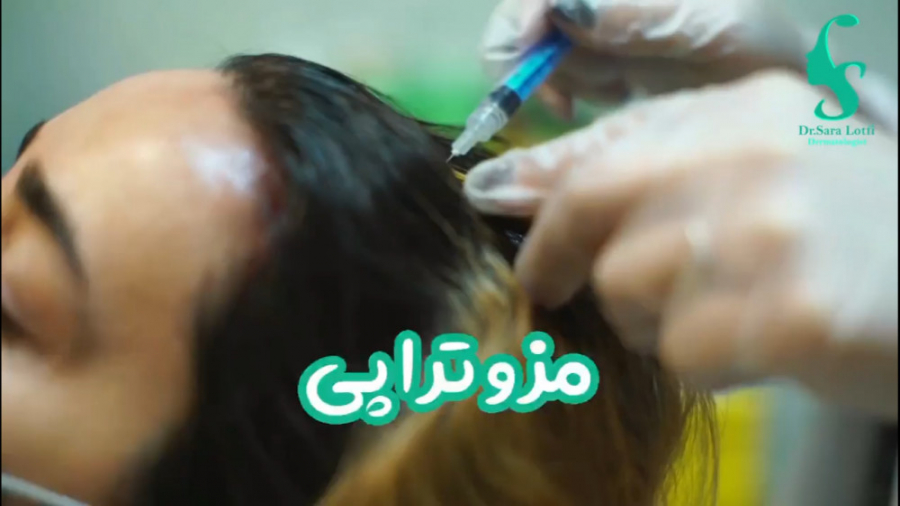 مزوتراپی مو دکتر سار ا لطفی
