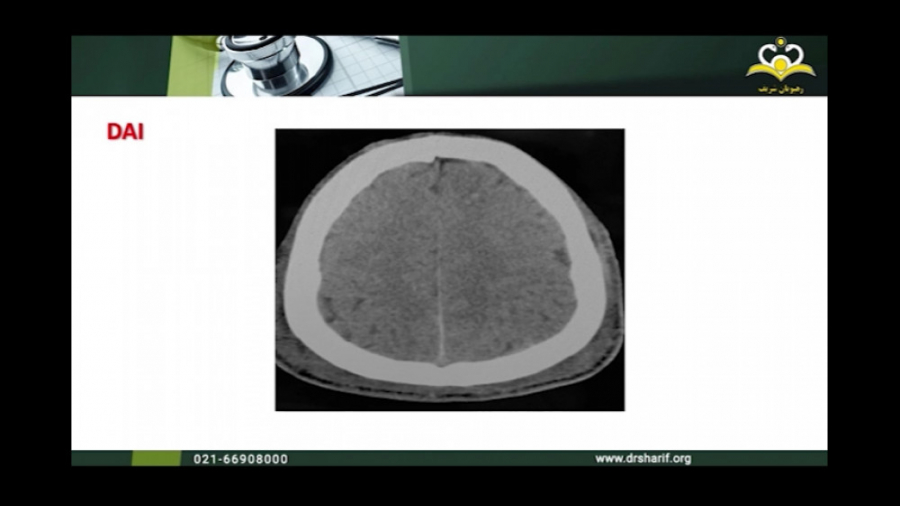 تصاویر Brain Ct و Brain MRI -رشته ی روان پزشکی -استاد اعظم علی اکبریان عمل زیبایی