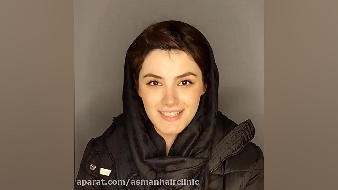 رضایتمندی مراجع لیزر کلینیک پوست و مو آسمان 1 دندانپزشک زیبایی