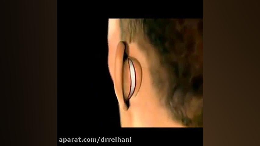 جراحی زیبایی گوش کلینیک زیبایی