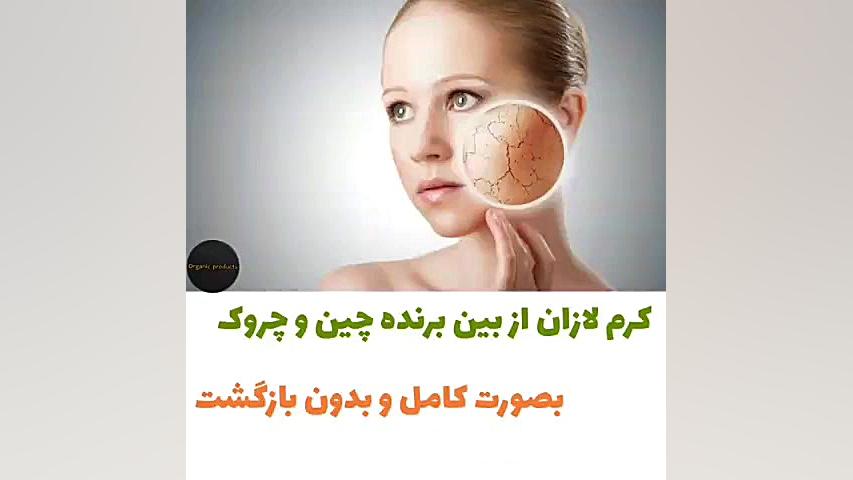 درمان لک ها و آکنه و جای جوش صورت رفع افتادگی پلک