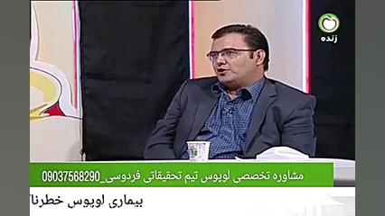 درمان قطعی لوپوس هایفوتراپی