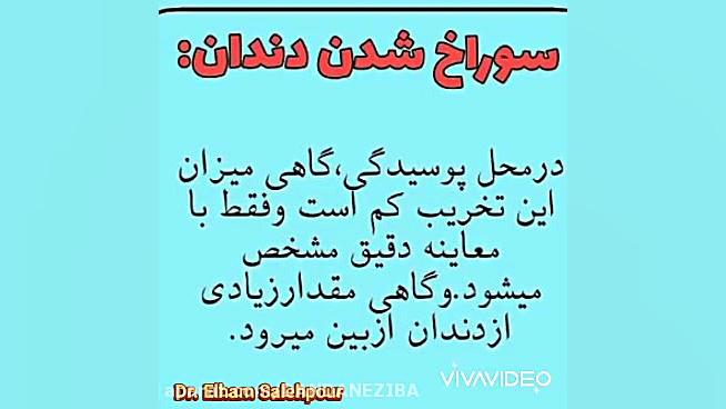 فیلم ترمیم پوسیدگی دندان پر کردن دندان با آمالگام و کامپوزیت دیسمورفی فاسیال