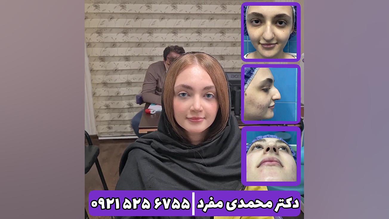 جراحی زیبایی بینی ، دکتر محمدی مفرد دکتر امیر حسین محمدی مفرد