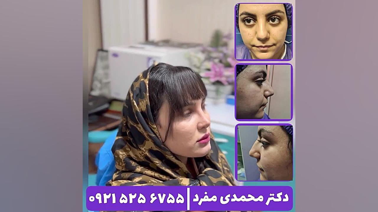 بهترین جراح بینی ، دکتر محمدی مفرد دکتر امیر حسین محمدی مفرد