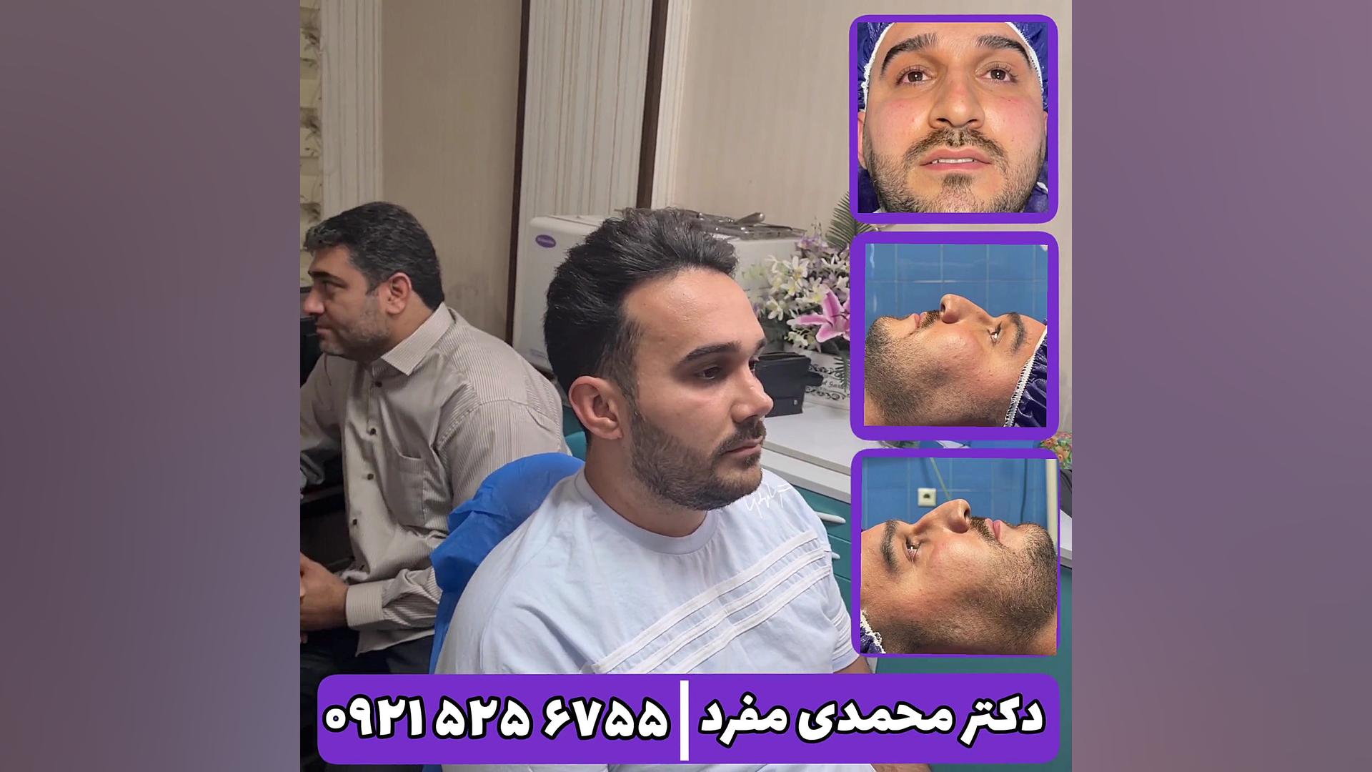 بهترین جراح بینی ، دکتر امیر حسین محمدی مفرد دکتر امیر حسین محمدی مفرد