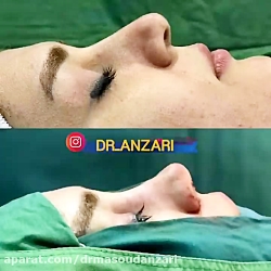 فیلم کامل و بدون سانسور از اتا...