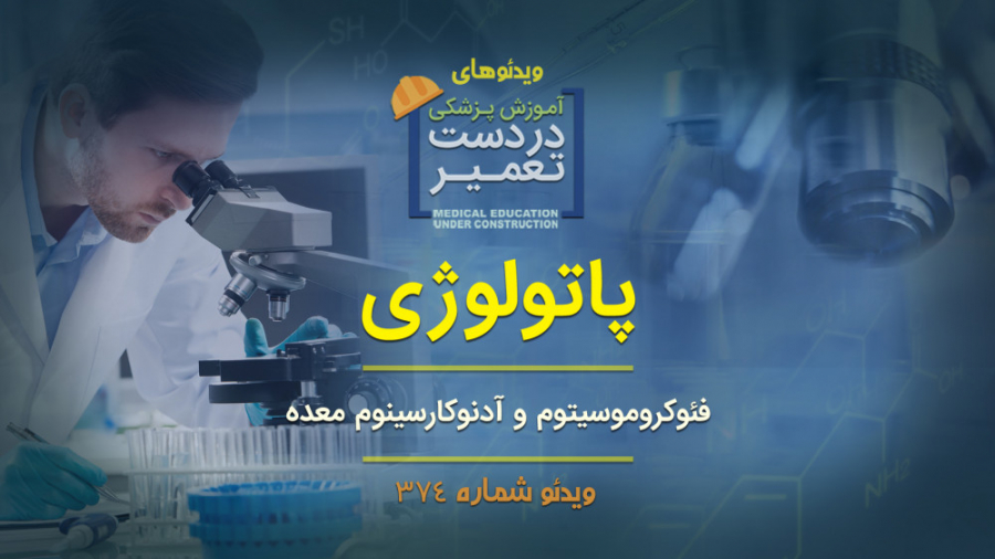 پاتولوژی (فئوکروموسيتوم و آدنوکارسینوم معده) روکش دندان