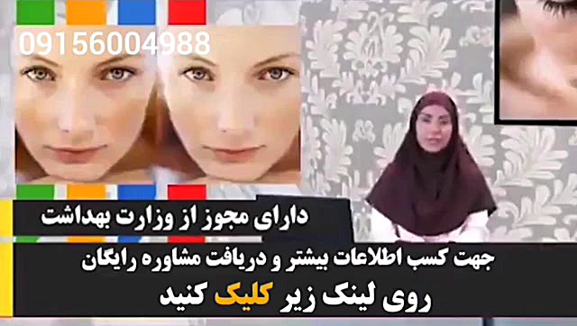 کشف درمان لک صورت کاملا گیاهی کاشت مو