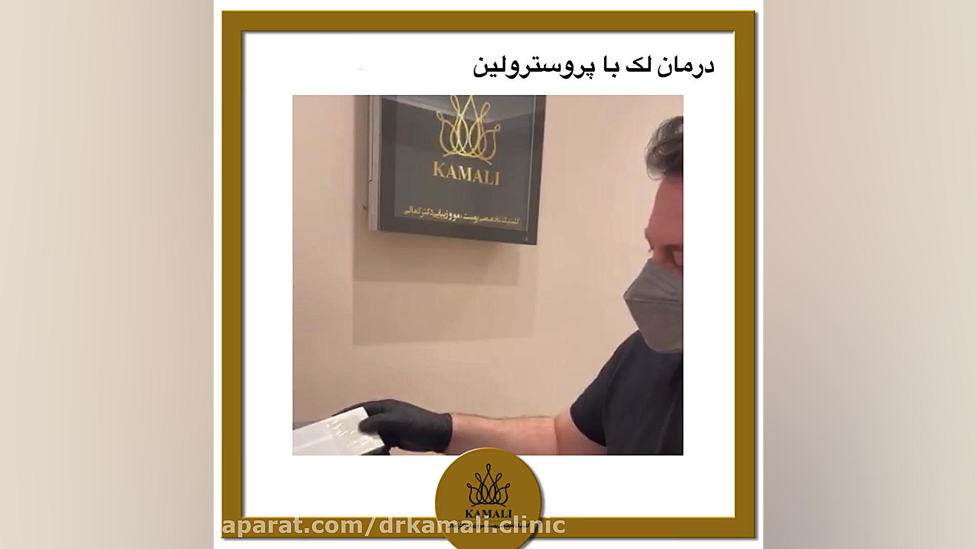 درمان لک با مزوژل پروسترولین در کلینیک تخصصی دکتر کمالی زیبایی پوست
