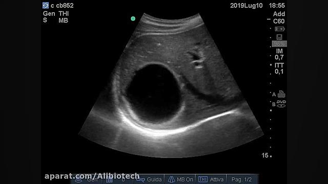 CE 1 (active stage) میوکلونوس