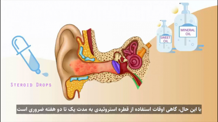علل اصلی خارش گوش کدامند؟ - زیرنویس فارسی بلیچینگ