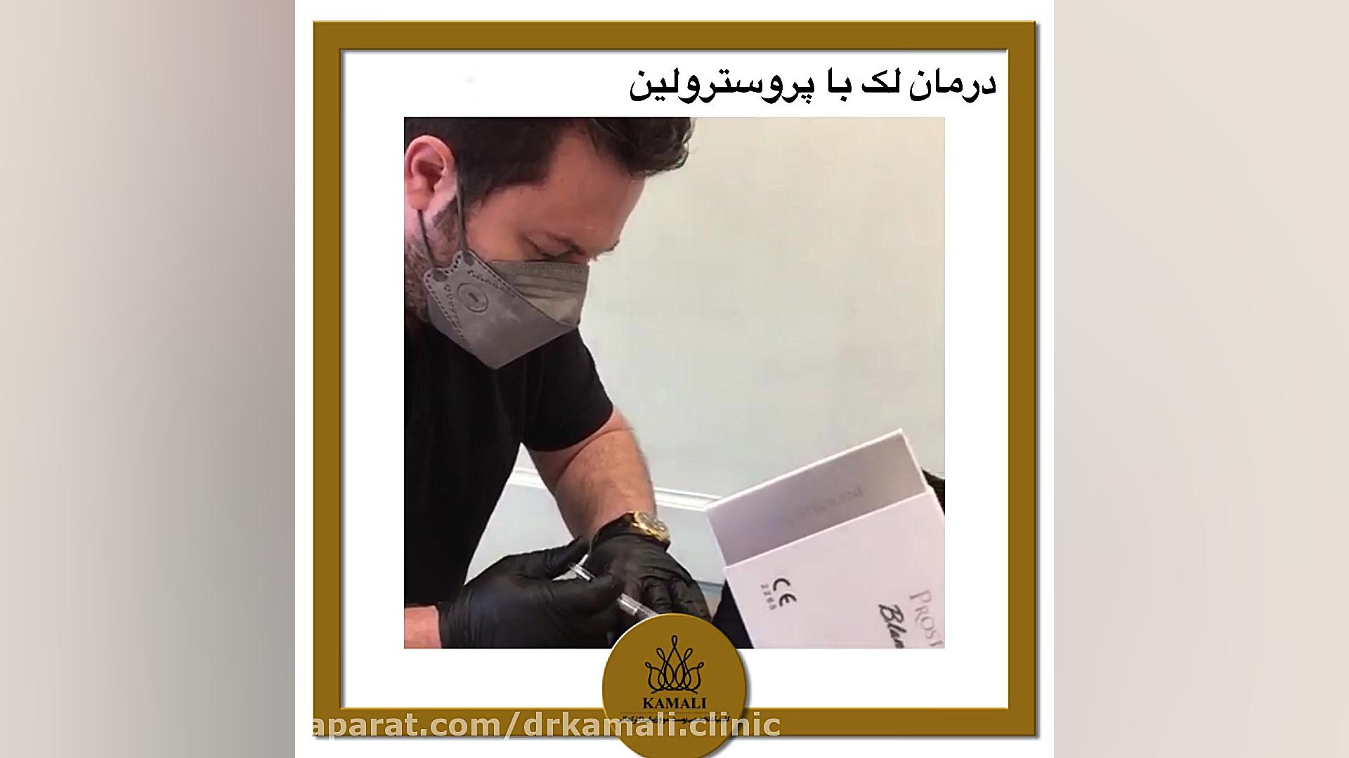 درمان لک با مزوژل پروسترولین در کلینیک تخصصی دکتر کمالی برداشتن زگیل