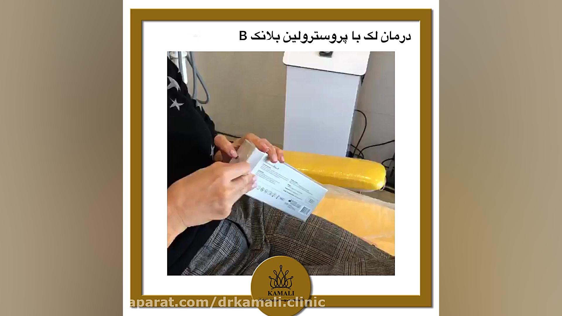 درمان لک با مزوژل پروسترولین در کلینیک تخصصی دکتر کمالی جراحی لثه
