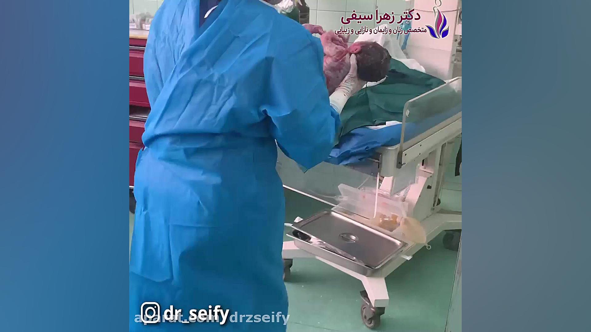 سزارین کاملا بدون درد با پمپ بی دردی | دکتر زهرا سیفی دماغ آلبالویی
