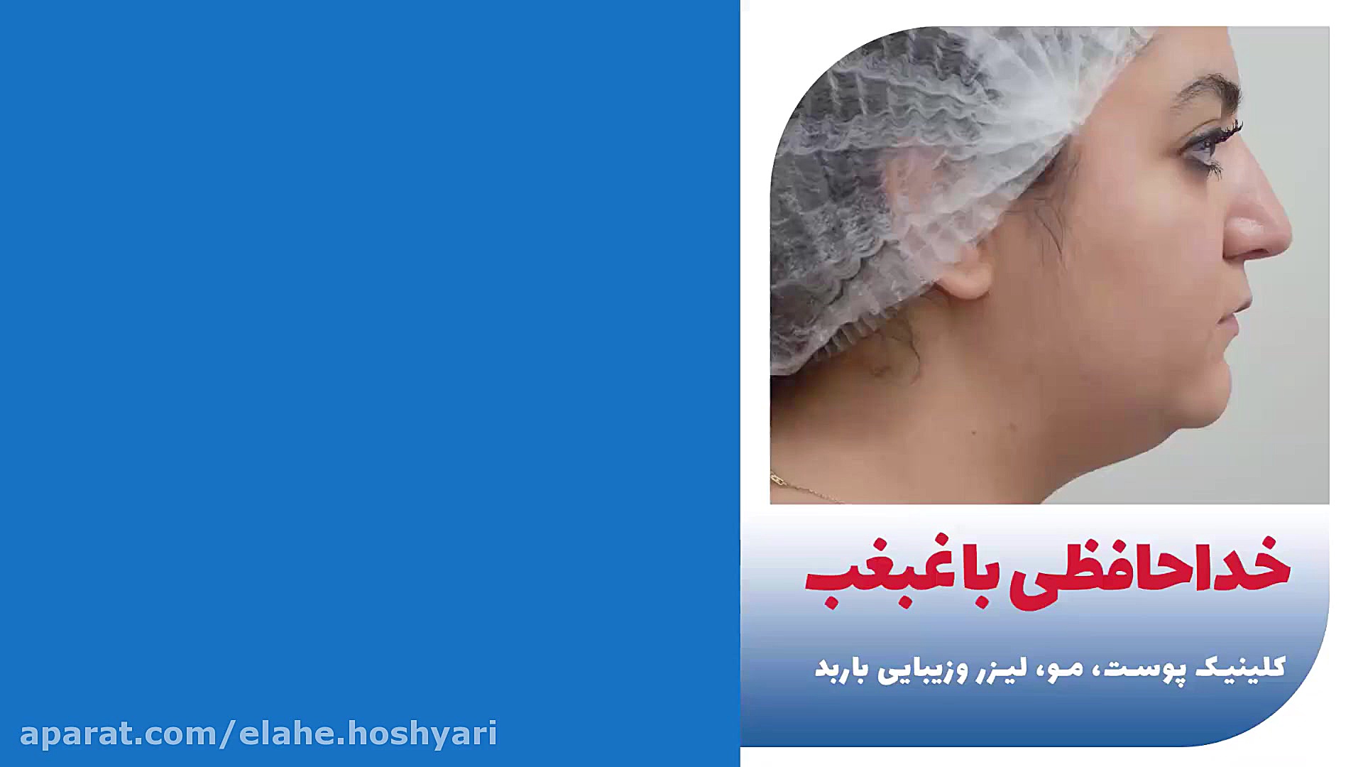 خداحافظی با غبغب با هایفو تراپی ربات میکرونانو جراحی