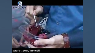 با تماشای این کلیپ دیگر لواشک و آلوچه نمیخورید لیفت صورت