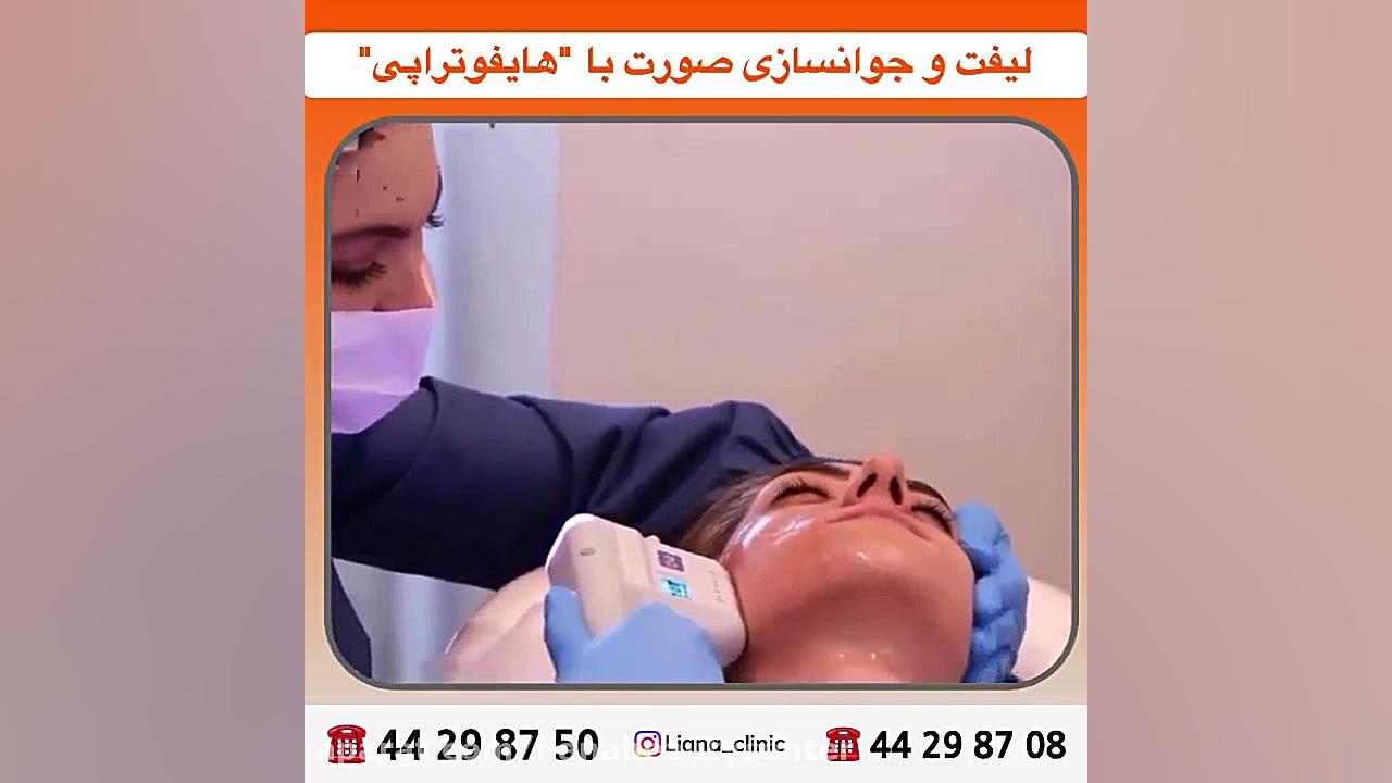 لیفت و جوانسازی صورت با هایفوتراپی جراحی زیبایی پلک