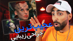 عجیب ترین جراحی زیبایی:عمل زیبایی صورت