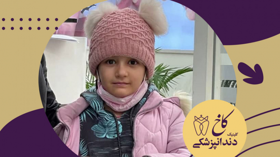 کودکان دلبر کلینیک کاخ کلینیک دندانپزشکی کاخ