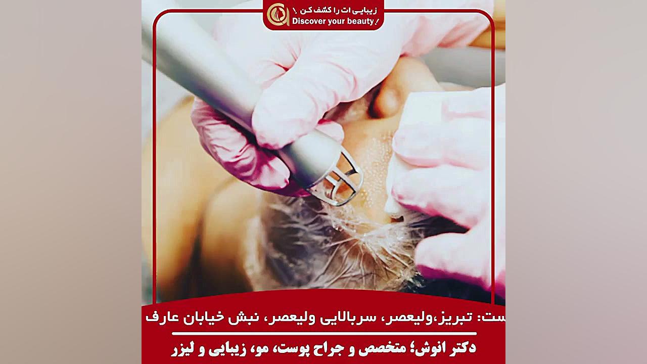 چند جلسه لیزر برای رفع موهای زائد نیاز است ؟ دکتر بهزاد انوش|متخصص و جراح پوست مو زیبایی و لیزر