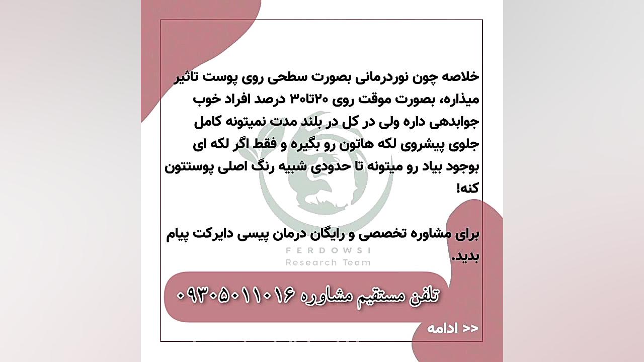 فتوتراپی یا نور درمانی برای ویتیلیگو تاثیر داره؟ کاور آهنگ