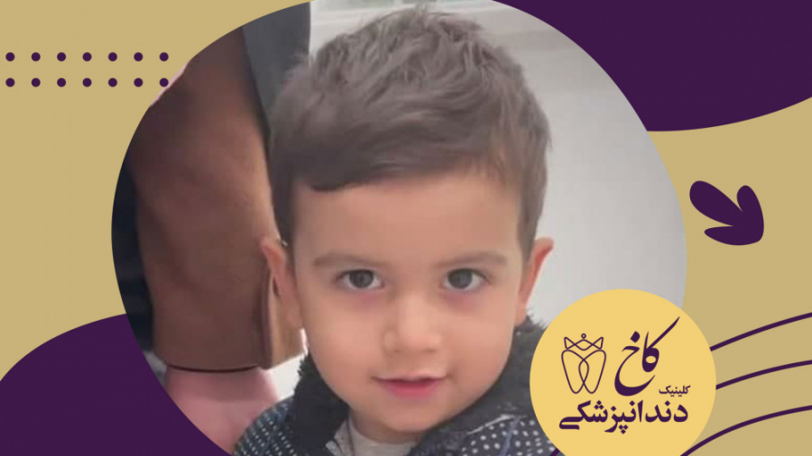 آقا کوچولوی ناز و خجالتی کلینیک کاخ کلینیک دندانپزشکی کاخ