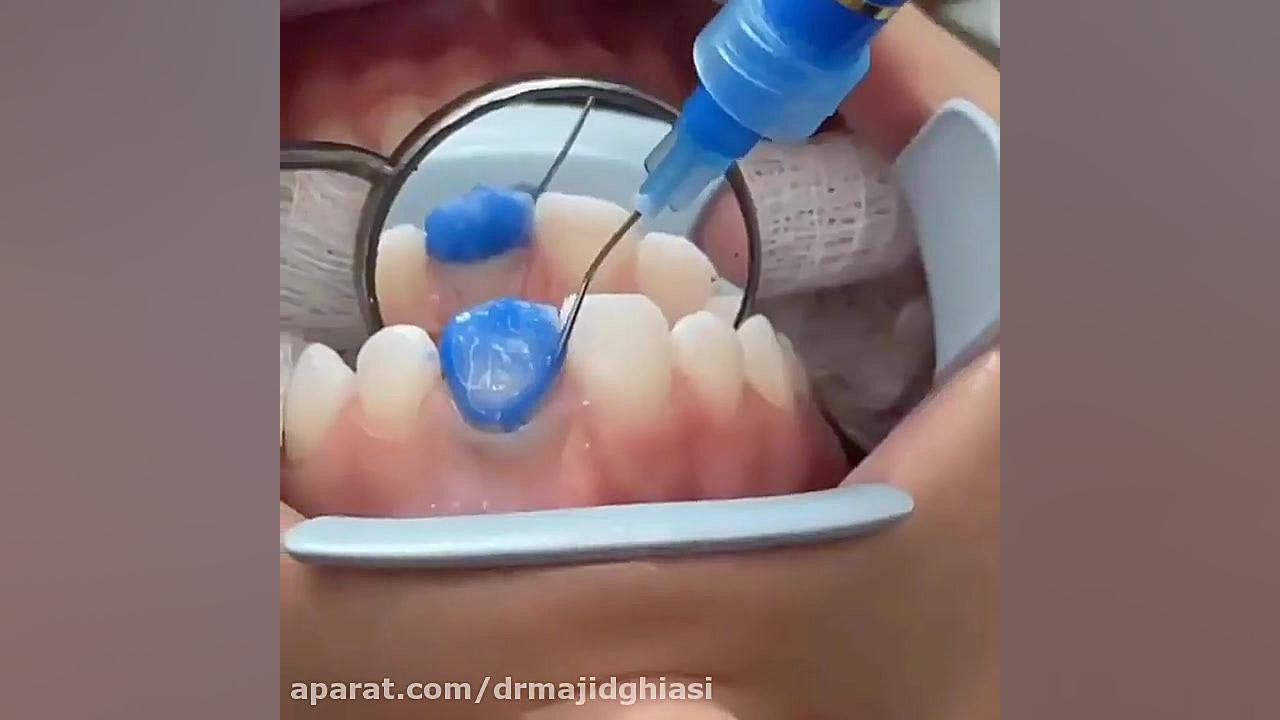 اصلاح طرح لبخند با درمانهای ترکیبی دکترمجیدقیاسی