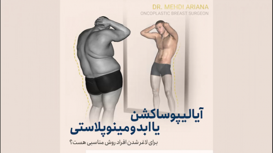 آیا لیپوساکشن یا ابدومینوپلاستی برای لاغر شدن افراد روش مناسبی است کربتوزوماب