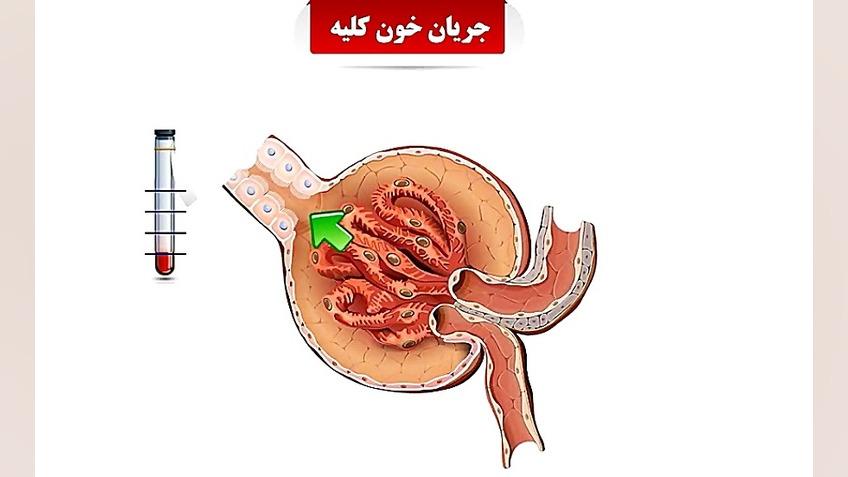 گردش خون کلیه دکتر حمید براهیمی