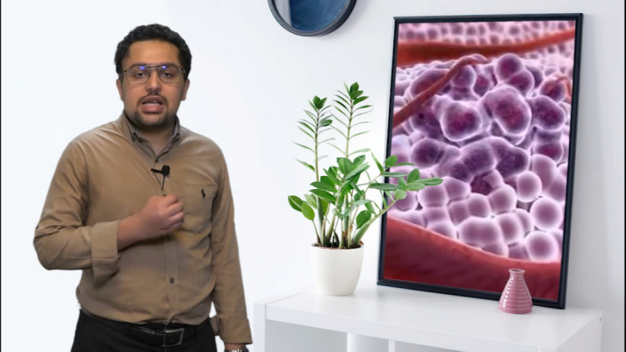 تیزر کلاس سرطان و شیمی درمانی آقای قاسم پور - بهمن 1400 ترمیم لبخند لثه‌ای