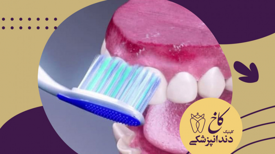 نحوه صحیح مسواک زدن کلینیک دندانپزشکی کاخ