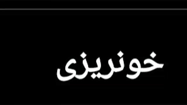 عوارض شایع همودیالیز مزوتراپی