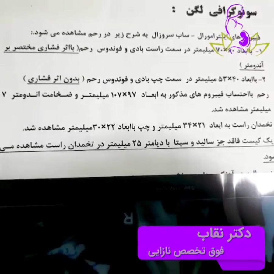 میومکتومی برداشت فیبروم رحمی)د...