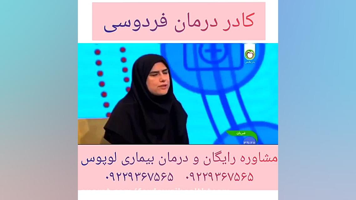 لوپوس چیست‌ و چگونه درمان میشود؟ جنیفر لوپز