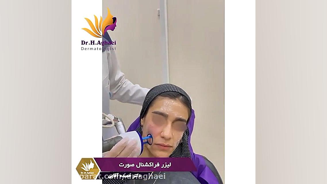 ترمیم و جوانسازی صورت با لیزر فرکشنال دکتر حمیده آقایی