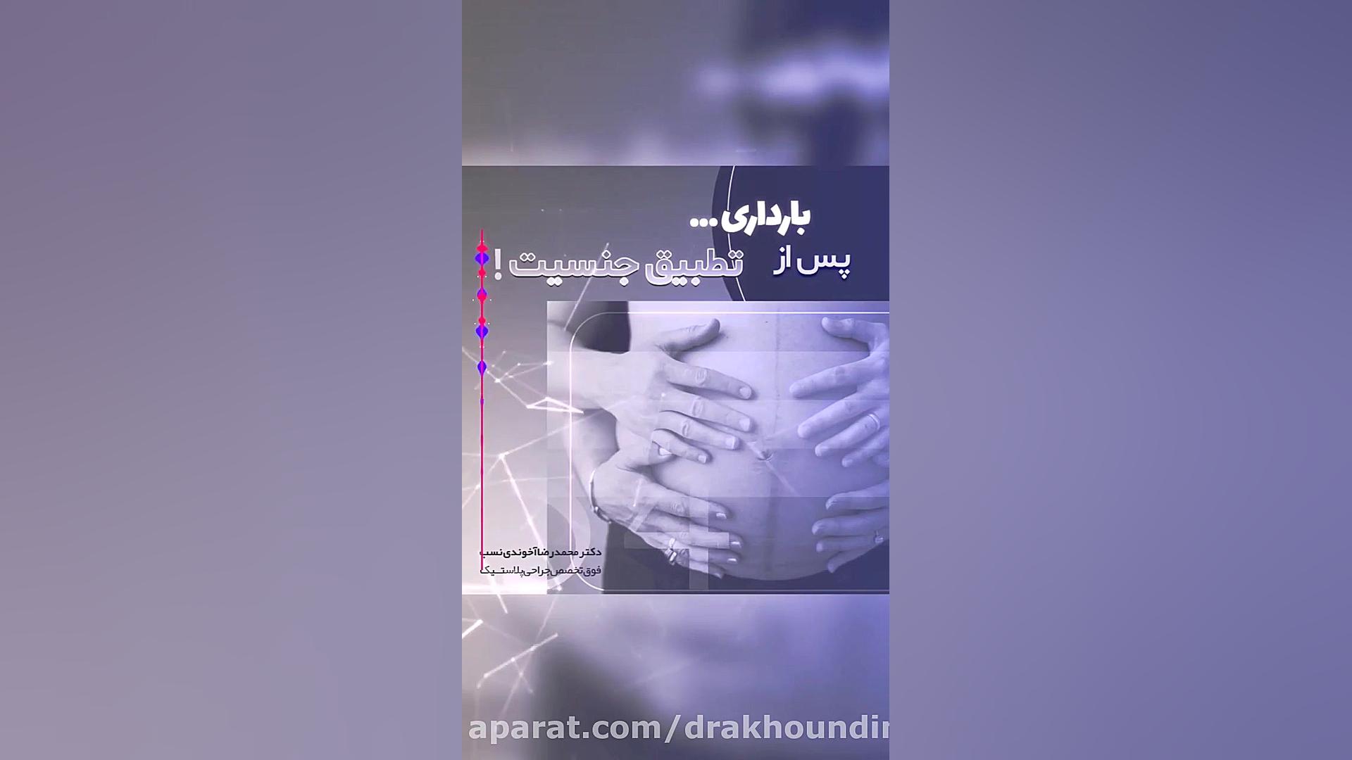 بارداری پس از تغییر جنسیت دکتر محمدرضا آخوندی نسب-فوق تخصص جراحی پلاستیک