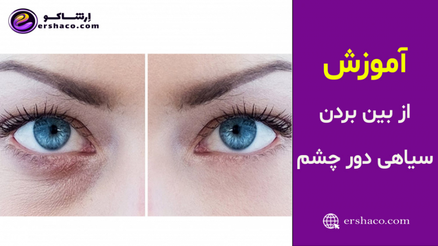 ارشاکو - از بین بردن سیاهی دور چشم