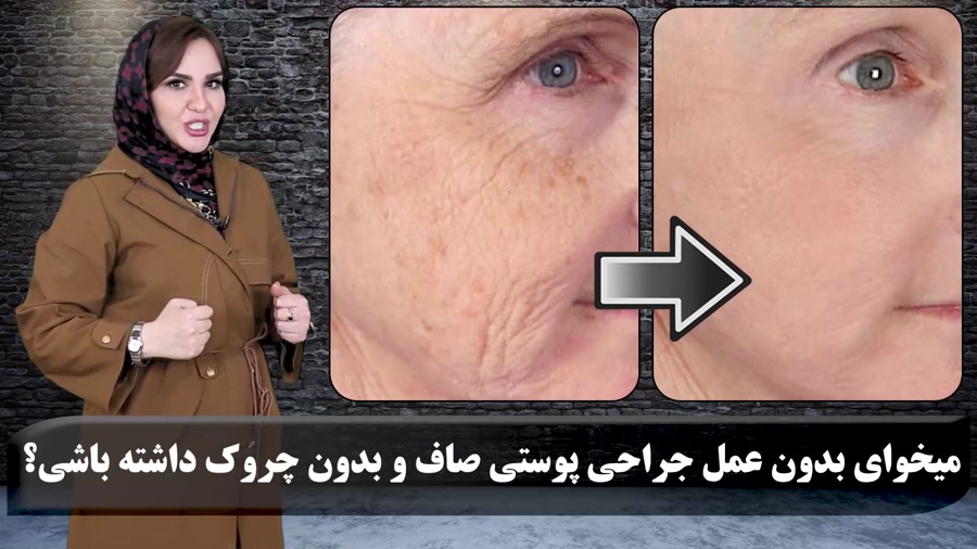 پوست صاف و بدون چروک بدون عمل و بوتاکس!!