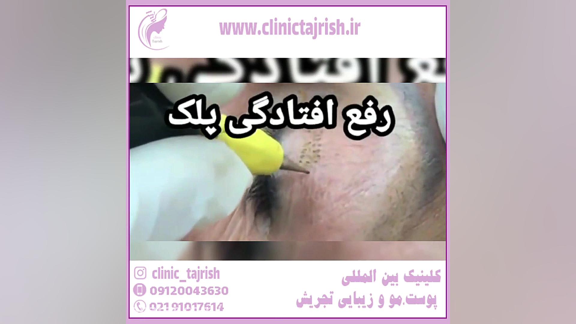 کاربرد ، مزایا و نتایج حیرت آور برای پلاسما جت تست تنفس اوره C13
