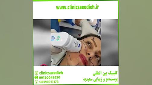 هایفوتراپی معجزه جوانسازی و لیفت صورت/هزینه و مزایا بیومهندسی عصبی
