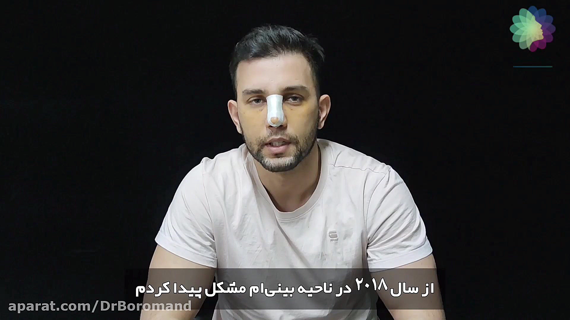 جراحی زیبایی بینی مراجعه کننده عزیز از کشور آلمان اصلاح طرح لبخند